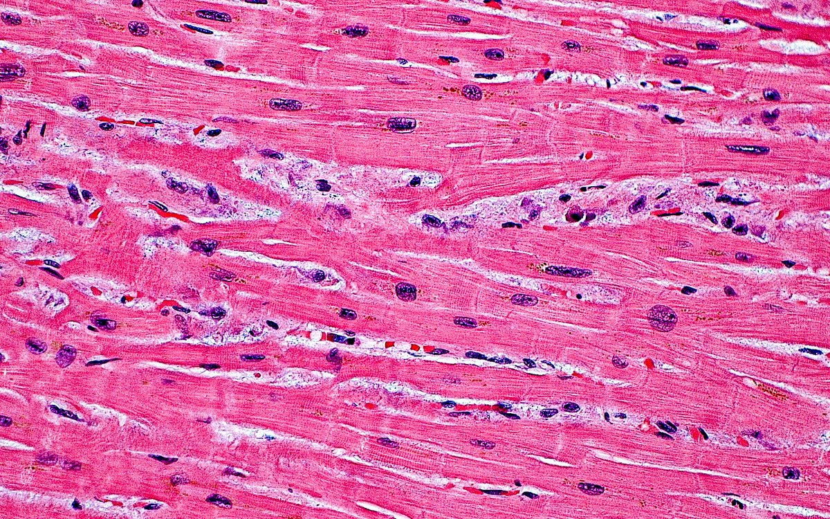 Cardiac Muscle ~ #PathArt

#histology #histoart #pathology #bioart #sciart #beauyinthebenign #microscopy