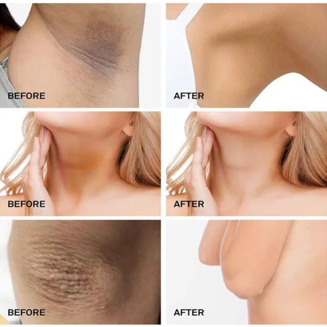 pinaaleee's tweet photo. Tips mencerahkan lipatan kulit gelap!

Save Aja Dulu, CO Nya Belakangan!✨

- a Thread - https://t.co/jWhTGaoKb9