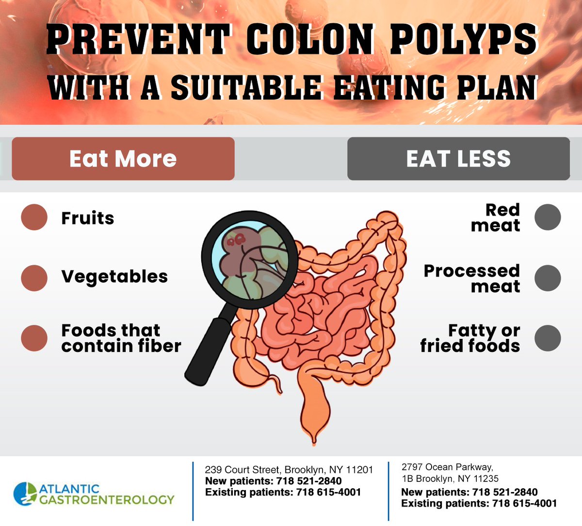 AtGastro_NYC's tweet image. Research suggests that following a healthy eating plan and limiting certain foods can reduce your chances of developing colon polyps. Maintaining a healthy body weight can help reduce the risk. #colonpolyps #brooklyn #atlanticgastroenterology #NY