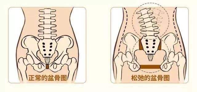 Roen_kr's tweet photo. 骨盆肌肉复原术从阴道入口开始到阴道里面的Sphinterani(肛门括约肌）肌肉和Pubococcygeus(耻骨尾骨肌）肌肉强化连接勒紧骨盆肌肉。这些肌肉的连接是增加收紧性关系时的肌肉。 #骨盆前倾 #私密整形 #女性健康 https://t.co/4Acg9b5dFL