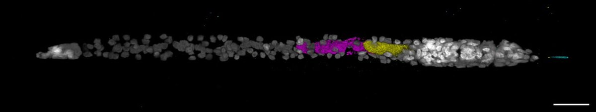 Wrap your eyeballs around this! New in situ protocol by @AlexisLSperling Multiple mRNA, in the same animal, sub-cellular resolution 🥲. Here is DG + SvG effector at the same time. Preprint: biorxiv.org/content/10.110… @plantsci @CropSciCentre