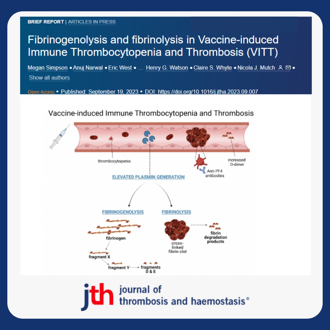 JTHjournal's tweet photo. Patients with Vaccine-induced Immune Thrombocytopenia &amp; #Thrombosis (VITT) 

▶️disseminated intravascular coagulation (DIC) displaying  plasmin-α2-antiplasmin complex 

&amp; plasmin generation ▶️ fibrinogenolysis, fibrinolysis ➕ FXIII consumption.

https://t.co/umSxHGTIDv https://t.co/1yn1825kfh