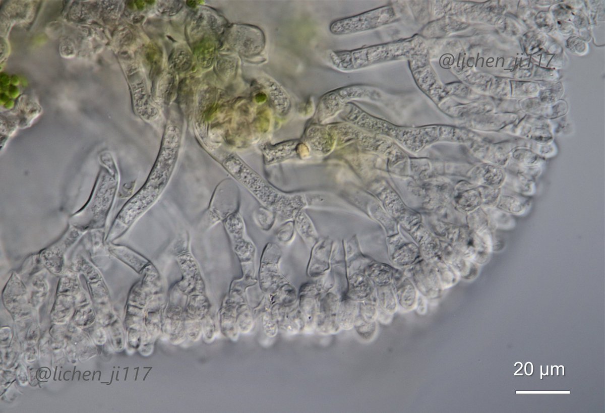 lichen_ji117's tweet image. 白いキノコの先。圧倒的、担子菌感。#clampless #hyphae #hymenium #Basidiocarp #Dictyonema #Basidiomycota