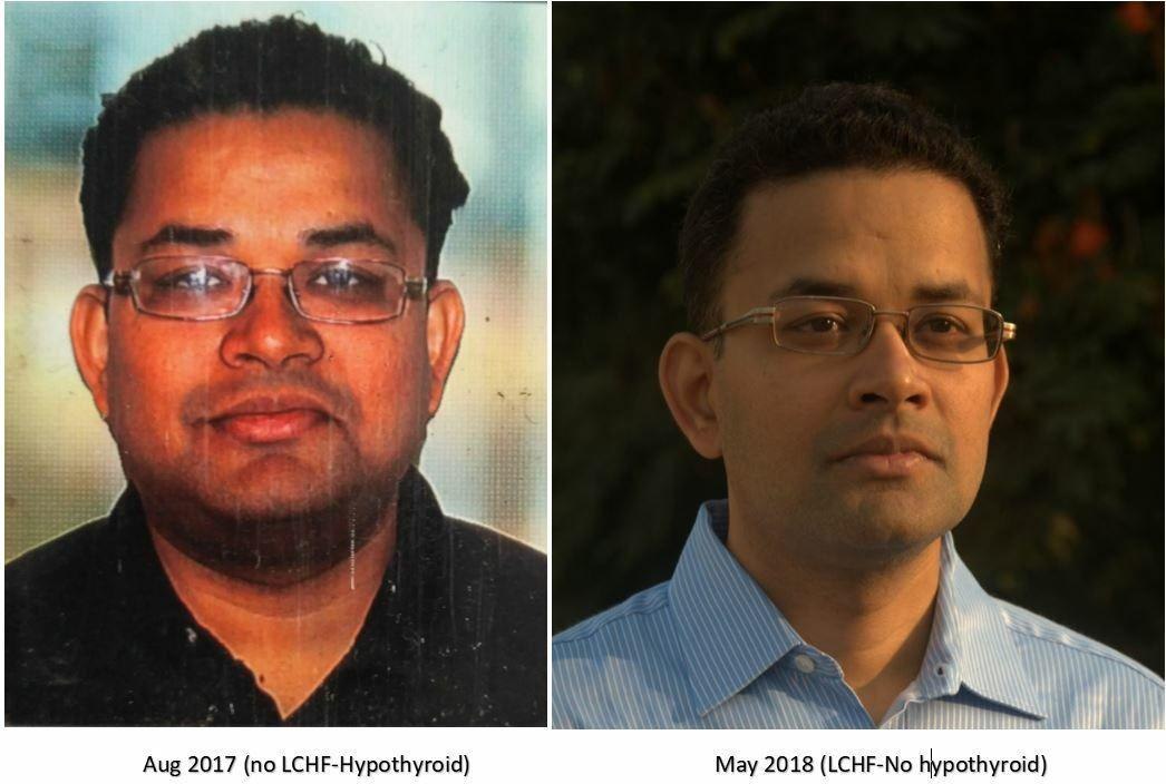 Low Carb way of eating (read: 'done correctly') worked , still works! Below is my Junk-Eating-Face(2017) vs Face with Proper Low Carb Eating (2018-till date)! 👇 #Lowcarb #MHCIndia2023 #MHC2023