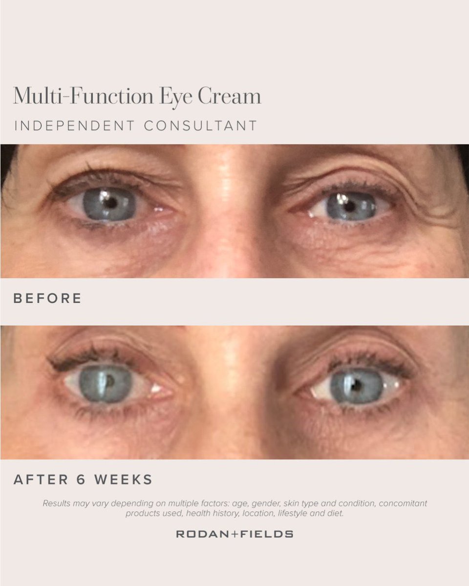 Go ahead and blink – just don’t miss these results 👀

Add our Multi-Function Eye Cream to your routine + say goodbye to the appearance of fine lines, wrinkles + crow’s feet.

#BeforeAfterRF #MultiFunctionEyeCream #RodanandFields #EyeCream