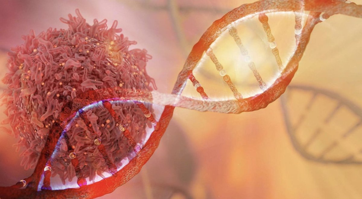 '11 genes linked to aggressive prostate cancer mutations'

feedkast.com/feeds/760

#prostatecancer