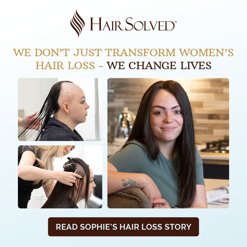HairSolved's tweet photo. For a few years, her bald patches were relatively small and easier to disguise. But when she got into her late teens, she couldnโt hide it anymore. You can read Sophie's Story here and find out why she no longer feels like two different people.
#alopeciaawarenessmonth
#notawig
