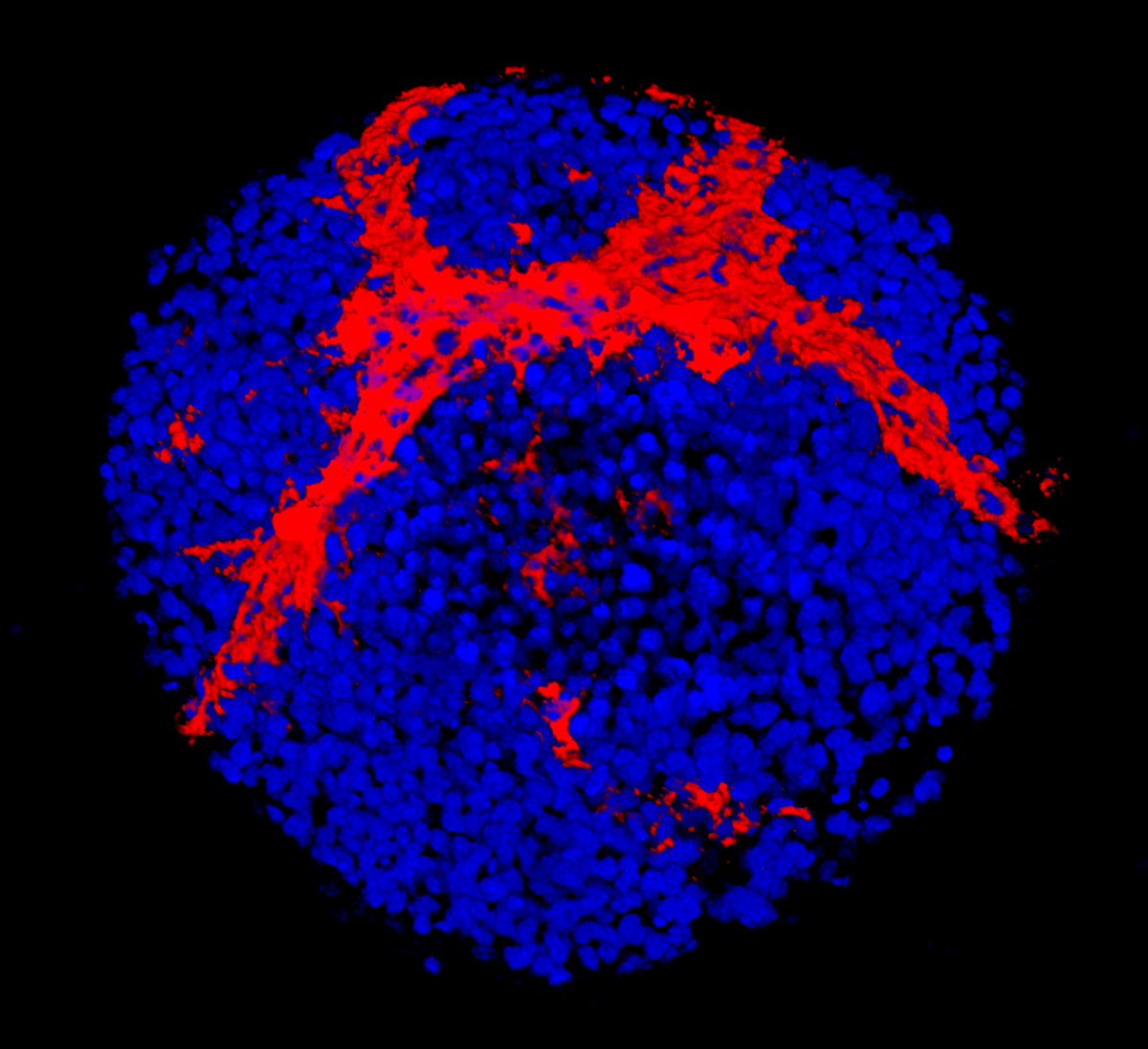 Read our latest research on #sex specific #genetics of #Liver disease published with @SpringerNature in @NatureMedicine check it out: rdcu.be/dmYbC