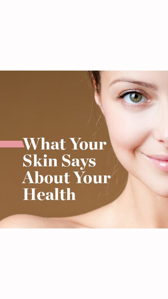 JuliaTHunterMD's tweet image. WHY you need supplements for your skin! Skin conditions must be treated internally and externally for optimal treatment to prevent progression, help resolution of symptoms caused by INTERNAL problems. #antioxidants #supplementsthatwork 
youtu.be/pjWJyMbDYio