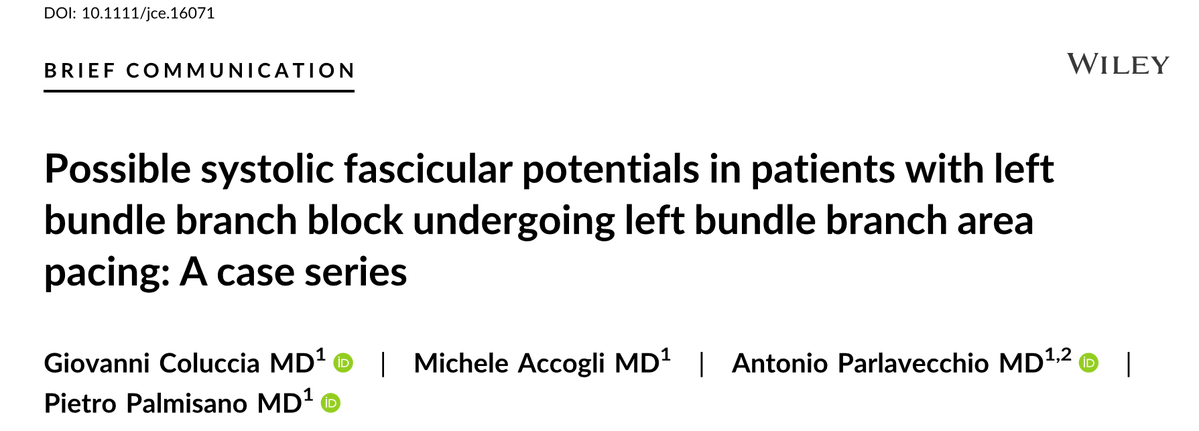 messapus's tweet photo. Our latest paper published @JCardioEP about (possible) systolic fascicular potentials in LBBB pts undergoing #LBBAP👉https://t.co/Vgdg6OWgiz. Inspiring physiology of #CSP! @gauravaupadhyay @MdHuang @Marek_Jastrz_EP @kvernooy @curilakarol @MargaridaPujol @micogriecomd @OCanoPerez https://t.co/nvZuNUSkjU