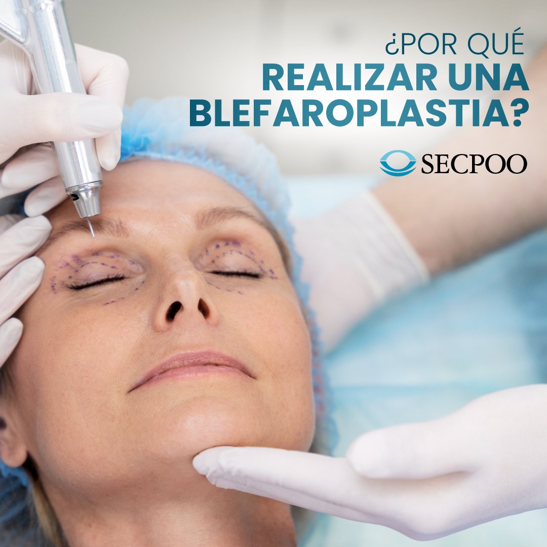 OculoplasticaES's tweet photo. ¿POR QUÉ REALIZAR UNA BLEFAROPLASTIA?
🧐Te lo contamos aquí: https://t.co/YIonpImfem
#secpoo #blefaroplastia #oculoplastia #secpoo https://t.co/tIbUDo5qiu