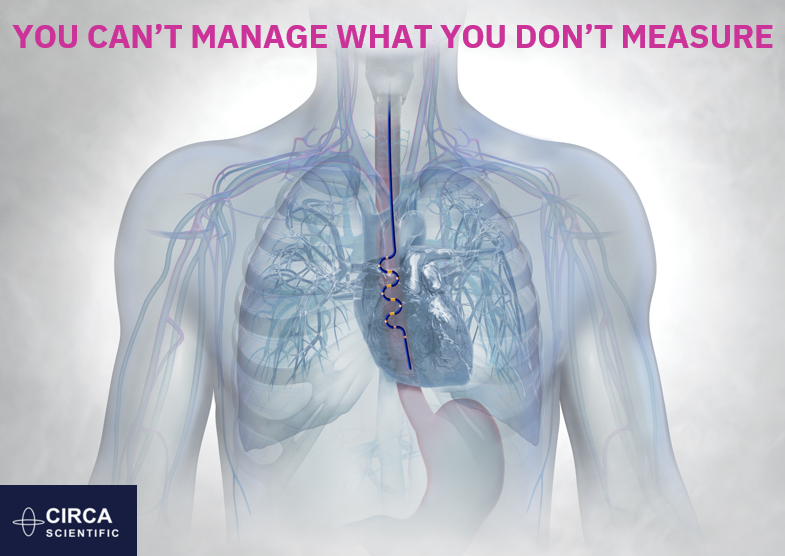 Esophageal Temperature Monitoring is Sensitive Business. 
See why CIRCA is TRUSTED with over 300,000 cases performed! 
Visit our website to learn more: hubs.li/Q023hwmQ0
