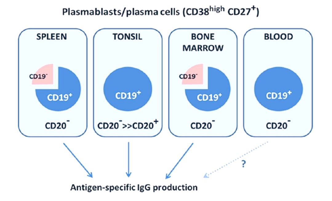 iamnephrologist's tweet photo. 🌸CD19 vs CD20

👉Both eventually lost from terminally differentiating plasma cell
👉CD19 persist on Plasmablast/few plasma cell after CD20 expression lost
👉CD19+CD20− cell in lymphoid tissue provide immune memory

Pic-Sagepub
#NephroNotes #FOAMed #MedTwitter #MedEd #NephPearls https://t.co/5T6Kddx7Au