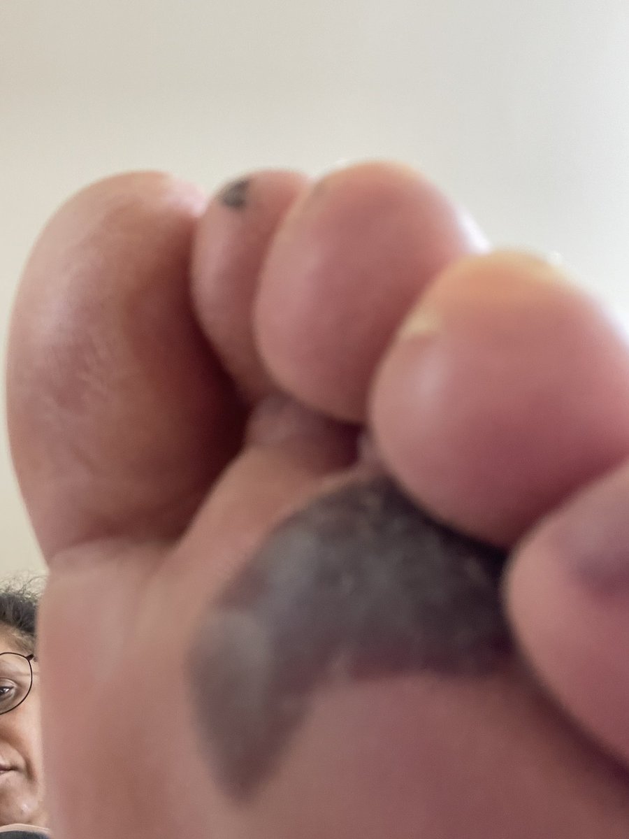 Balbinder Mattu tweet media