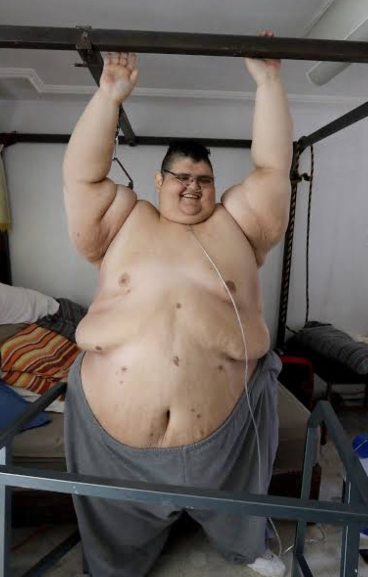 ashok_apna_AK's tweet photo. Juan Pedro Franco, a Mexican national, gained notoriety for being one of the heaviest individuals alive, weighing over 1,100 pounds (500 kilograms) at his peak.

His extreme obesity led to severe health issues, including diabetes and heart problems. 

In 2017, he underwent weight loss surgery to address these health challenges, closely monitored by a dedicated medical team. 

His journey was the subject of an international documentary called "The World's Heaviest Man," shedding light on the broader issue of obesity and its consequences.
