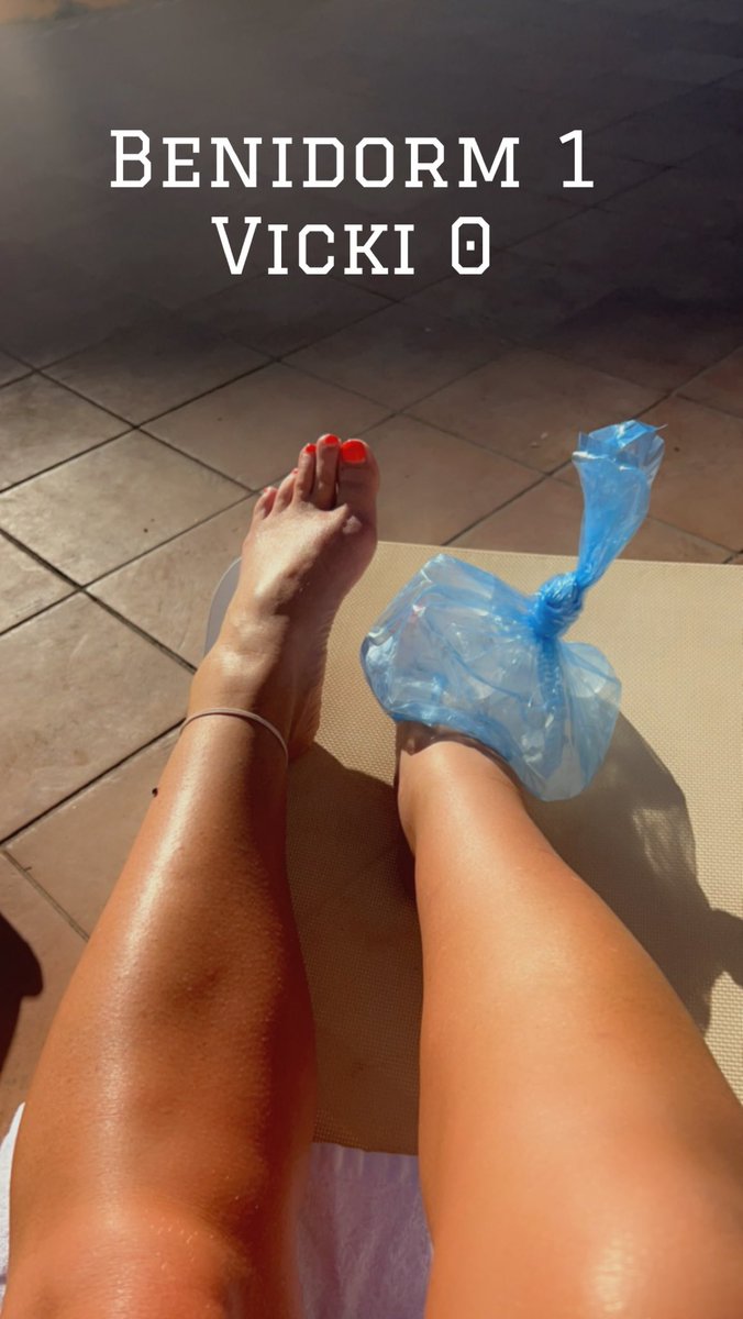 vtranter's tweet photo. Day 1 V Day 4 #Benidorm #DoneIn https://t.co/icP4fVYgw5