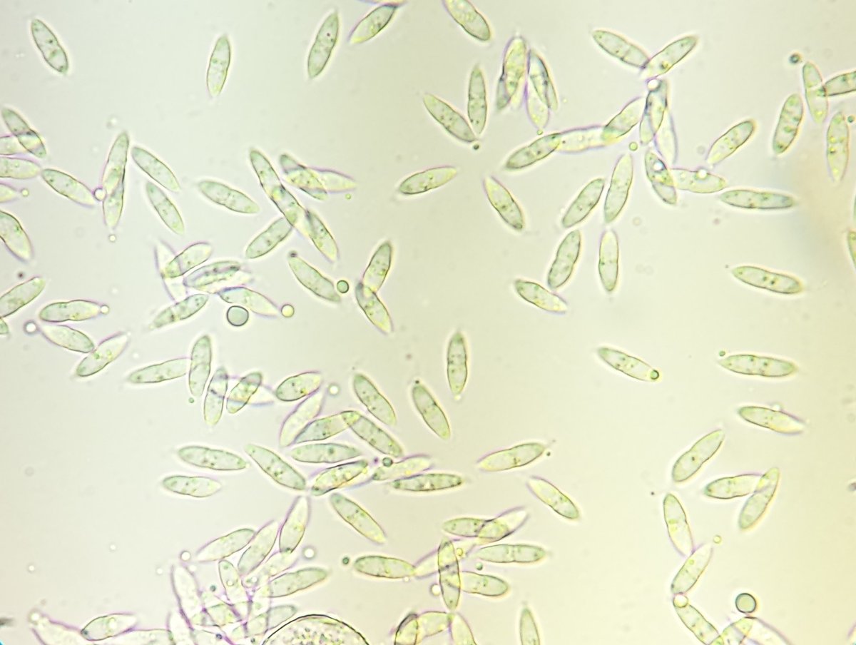 PavelSinkyrik's tweet photo. For the first time I was able to photograph and microscope the hyperparasite rust on Puccinia menthae. It's just a pity that I didn't take pictures of the pycnidia themselves which look quite aesthetic. #rust #hyperparasite #plantdiseases #puccinia https://t.co/RozWH5rNbg