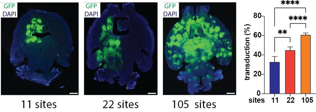 Jerzy Szablowski (@jerzyszablowski) on Twitter photo News story about the paper led by <a href="/Shinouraein/">Shirin Nouraein</a> in our lab. Ultrasound can enhance delivery of AAV to throughout the brain, without neuronal or weight loss. Widespread delivery improved both the spatial distribution and efficiency.
nature.com/articles/s4143…
bioengineering.rice.edu/news/rice-doct… News story about the paper led by <a href="/Shinouraein/">Shirin Nouraein</a> in our lab. Ultrasound can enhance delivery of AAV to throughout the brain, without neuronal or weight loss. Widespread delivery improved both the spatial distribution and efficiency.
nature.com/articles/s4143…
bioengineering.rice.edu/news/rice-doct…