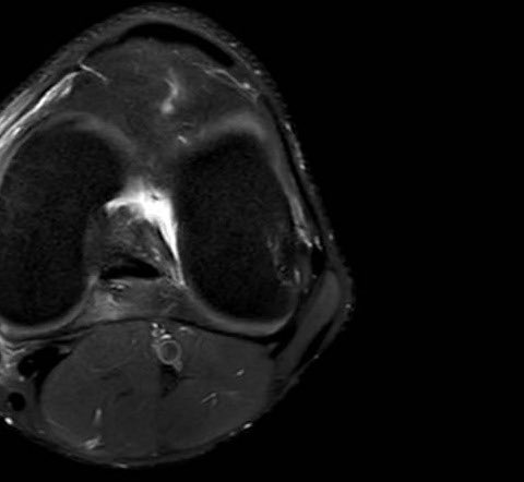 FigazzaFC's tweet photo. 🚑PARTE MÉDICO:

Ignacio Pazos: Luxación de rodilla y disfunción erectil- 10/14 días https://t.co/SVTRUj6KYG