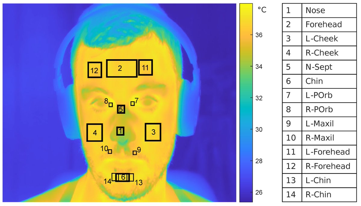 Sensors_MDPI's tweet photo. #highlycitedpaper
Towards a Contactless Stress Classification Using Thermal Imaging
https://t.co/KipuV4rDkE
#thermal_imaging #stress_detection #wearable_systems #support_vector_machine #contactless https://t.co/vGrWkkJnDn
