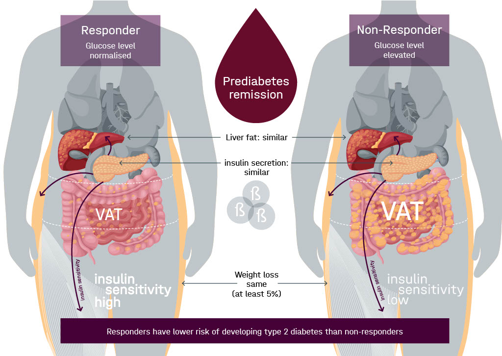New concept &amp; mechanisms for remission of prediabetes from PLIS Study conducted in DZD <a href="/DiabResearch/">Deutsches Zentrum für Diabetesforschung (DZD)</a> <a href="/HelmholtzMunich/">Helmholtz Munich | @HelmholtzMunich</a> <a href="/uktuebingen/">Uniklinikum Tübingen</a> Remission prevents T2D; improves markers of kidney function; vascular integrity 
Free access to article lancet d&amp;e  authors.elsevier.com/a/1hplZ7tNucn7…