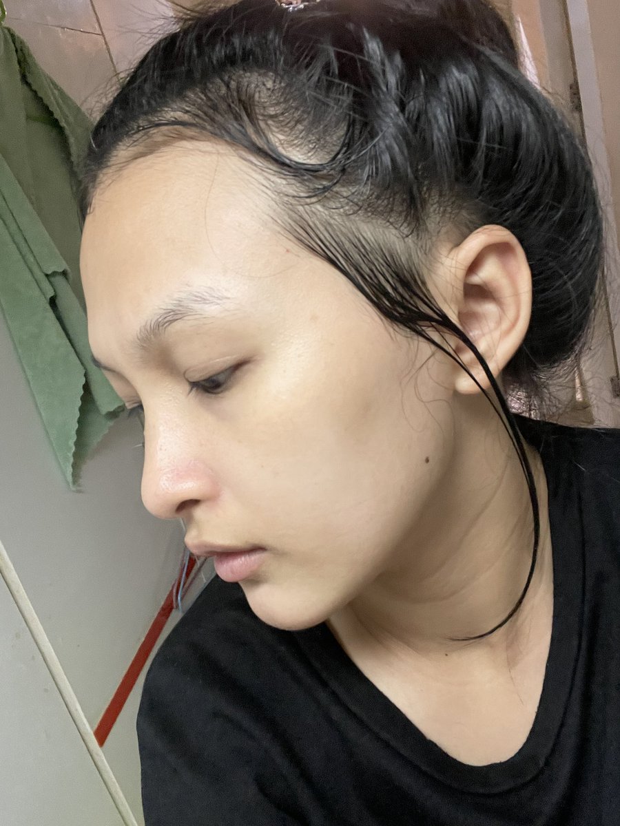 Cccviewwww's tweet photo. หน้าหลังใช้smooth e จากคนหน้าเคยแห้งมากๆๆ หลังใช้7วันรู้สึกหน้ามีความชุ่มชื้นมากยิ่งขึ้นแล้วรอยสิวลดลงด้วยใครสนใจอยากทดลองใช้เหมือนกันกดลิงค์ได้เลยนะคะ 
#รีวิวShopee #รีวิวLazada #ของมันต้องมี #ของดีบอกต่อ 
✅https://t.co/JBtYNswKez https://t.co/FKnSNeqBS4