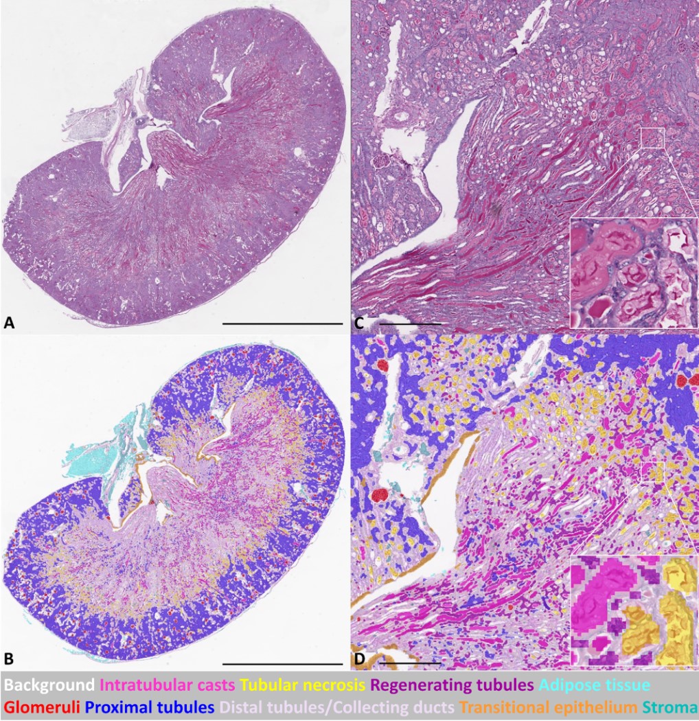 This #TechnicalTuesday we are highlighting the deep-learning method employed by <a href="/AndreeaLuchian6/">Andreea Luchian</a> and colleagues to quantify acute kidney injury in a mouse model.
📖<a href="/BiologyOpen/">Biology Open</a>:  journals.biologists.com/bio/article/12…