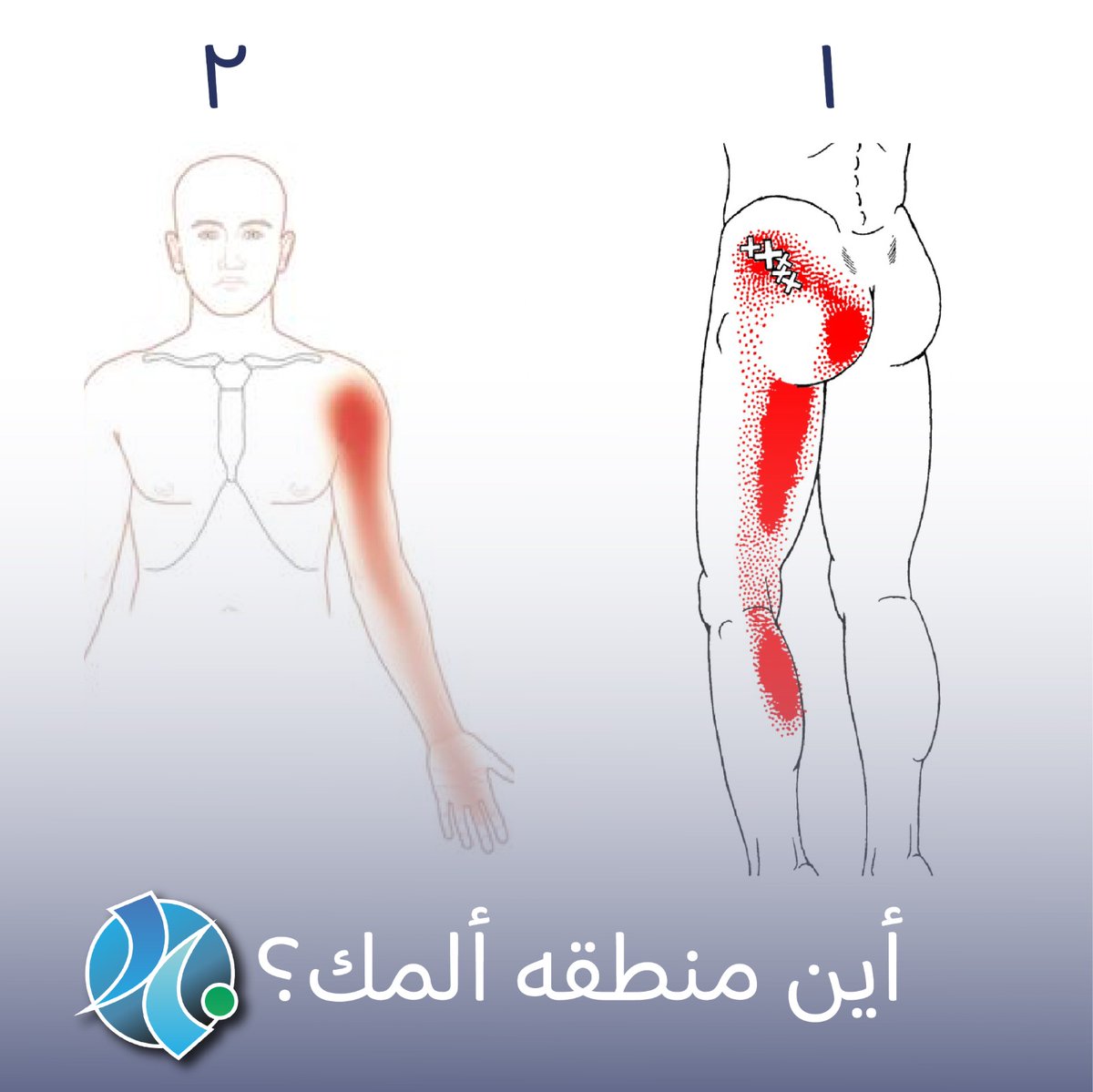 اي من الصور الاتيه يعبر عن مكان ألمك الذي تعاني منه 
ألم الساق 💬                                    ألم الذراع 🔄