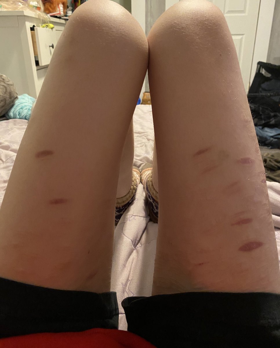 calystocals's tweet image. I cant put stuff between my legs anymore it just falls through☠️