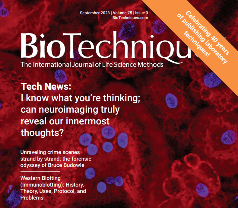 🎂🚨 New Publication Alert 🚨🎉 

Go <a href="/MyBioTechniques/">BioTechniques</a>, it’s your birthday! 🎉 Discover our rich history, insightful interviews and the lab techniques that have defined the last four decades >>> 

📸 <a href="/Chandekarsay9/">Sayali Chandekar</a>  

bit.ly/3Lyh1PE