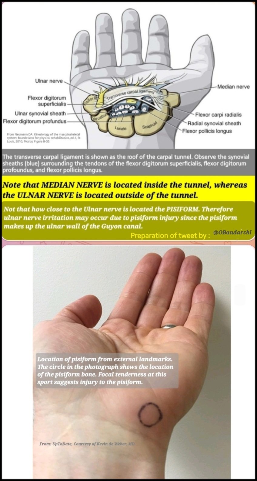 Dr. OMID BANDARCHI on X: Median nerve located inside the tunnel