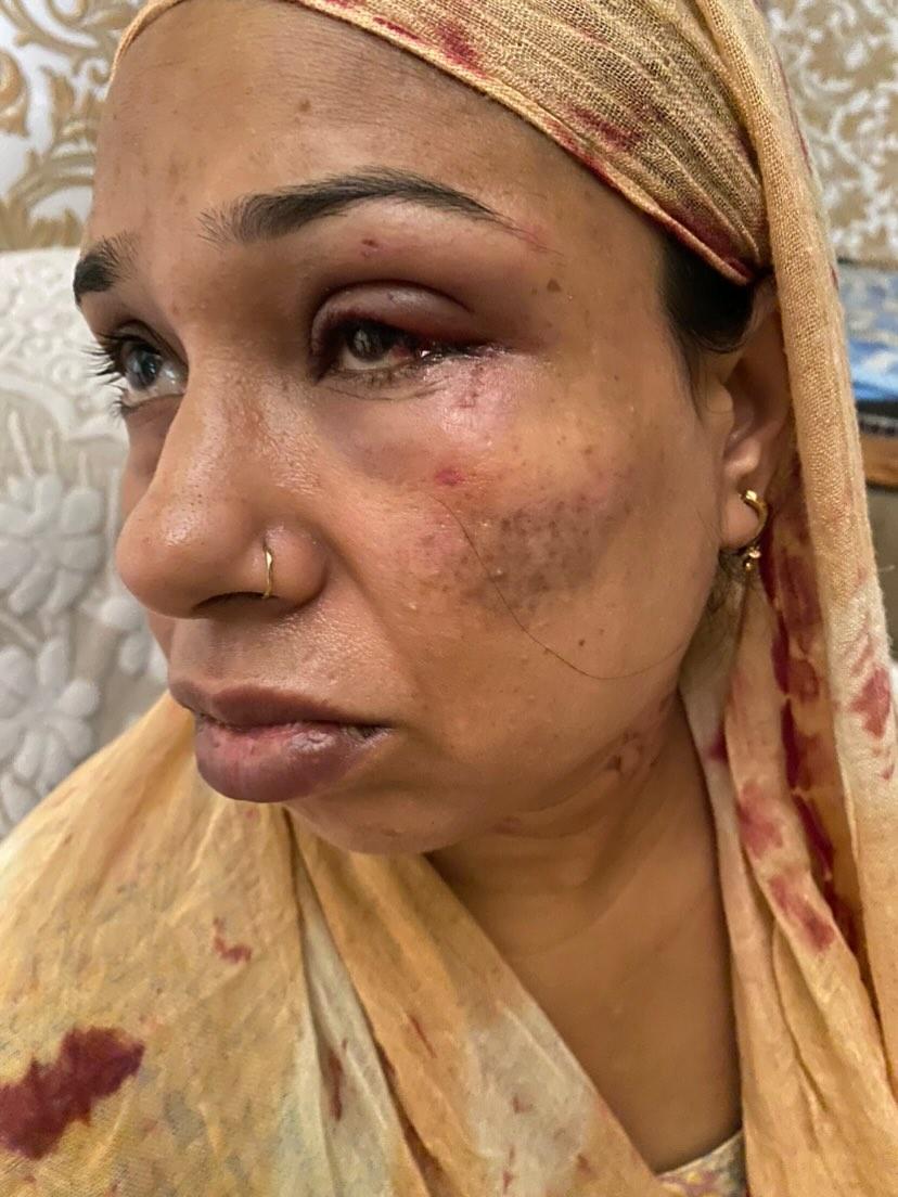 rc_advocate's tweet photo. Accused committed crime on 2nd sep, MLC done FIR was registered under sec 308 on 3rd Sep in PS Nandgram  Gzb, accused in the case was already convicted for 10 years from session court Gzb is out on bail from HC.Still no action by @ghaziabadpolice. Please help @myogiadityanath https://t.co/hRUGuGzeAB