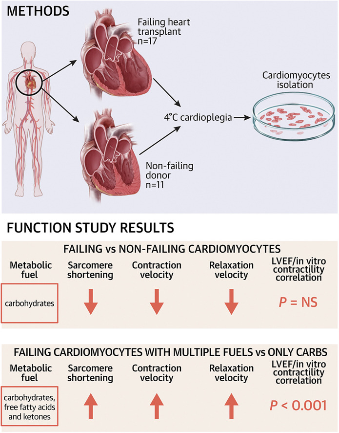 Margulies Lab (@margulieslab) on Twitter photo New paper alert! Led by <a href="/AlexiaVite93/">Alexia Vite</a> : Functional Impact of Alternative Metabolic Substrates in Failing Human Cardiomyocytes
sciencedirect.com/science/articl…
<a href="/JACCJournals/">JACC Journals</a> <a href="/AranyLab/">The Arany lab</a> <a href="/DanKellyPennCVI/">Daniel P Kelly</a> <a href="/PennCVI/">PennCVI</a> <a href="/kbedi88/">Ken Bedi</a> New paper alert! Led by <a href="/AlexiaVite93/">Alexia Vite</a> : Functional Impact of Alternative Metabolic Substrates in Failing Human Cardiomyocytes
sciencedirect.com/science/articl…
<a href="/JACCJournals/">JACC Journals</a> <a href="/AranyLab/">The Arany lab</a> <a href="/DanKellyPennCVI/">Daniel P Kelly</a> <a href="/PennCVI/">PennCVI</a> <a href="/kbedi88/">Ken Bedi</a>