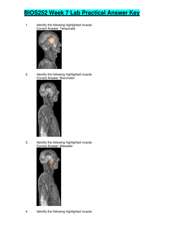 StudyResoures's tweet image. BIOS 252 Week 7 Lab Practical Answer Key (120 Q &amp;amp; A) / BIOS252 Week 7 Lab Practical (Latest): Anatomy and Physiology II: Chamberlain College
#bios252 #labpractical #anatomy #physiology #fliwy 
fliwy.com/item/348721/bi…