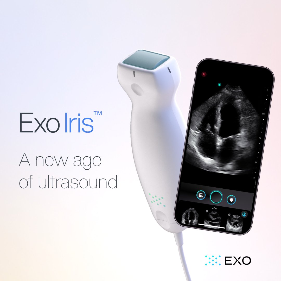 Meet Exo Iris™, our category-redefining handheld #ultrasound that brings a #medicalimaging ecosystem to your pocket! Our combined imaging, workflow software &amp; AI provide immediate answers at the point of care.

➡️ hubs.la/Q023nY6v0

#ExoAnswers #POCUS #ExoIris #MedTwitter