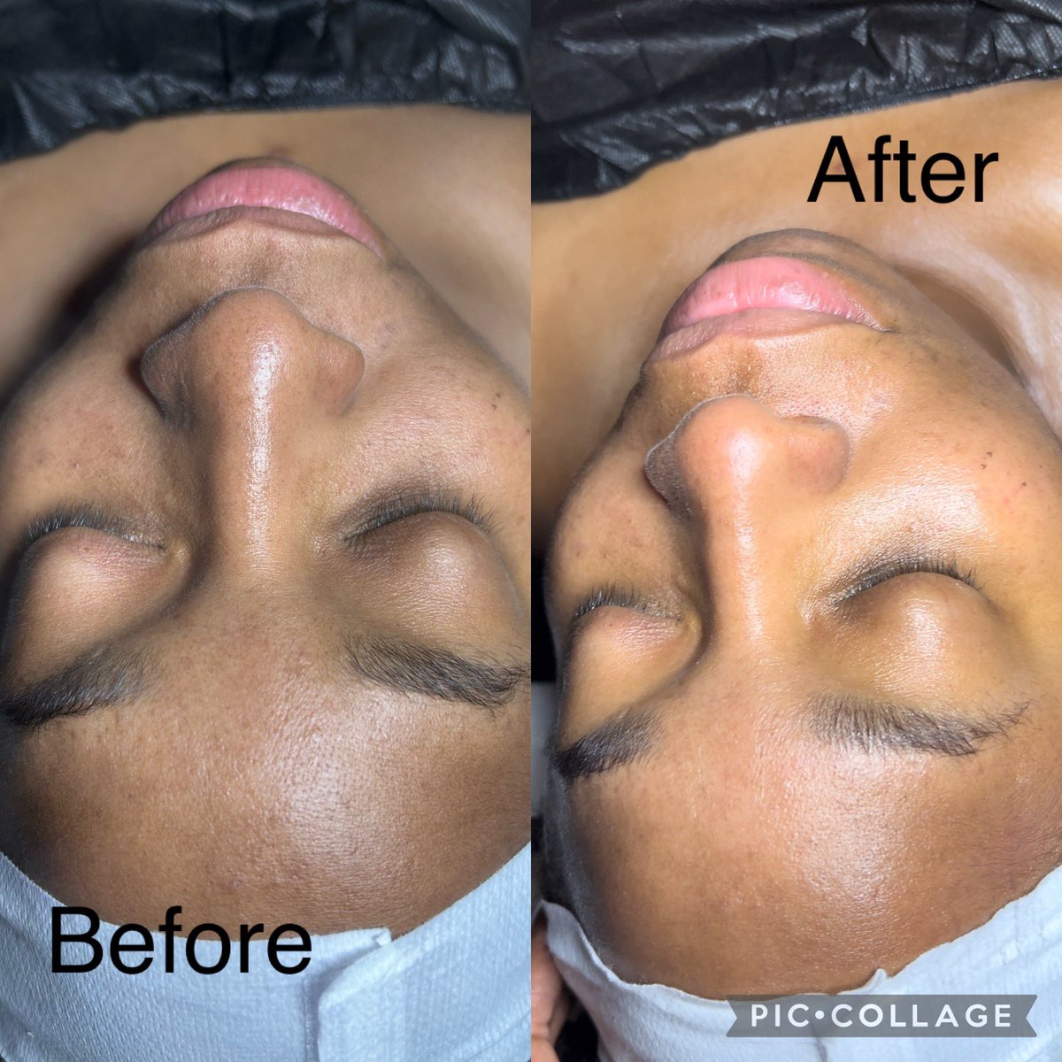 callme__shaa's tweet photo. Fun fact : I’m a licensed esthetician and i truly believe you should come give me a visit 🥰

Brighter skin after just ONE treatment https://t.co/Nb9uV8suoZ