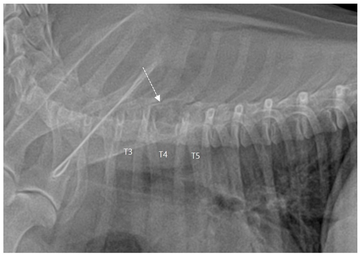 Vetsci_MDPI's tweet image. 📌Postoperative #Computed #Tomographic Assessment of the Complete Resection of an Infiltrative #Lipoma Compressing the #Spinal #Cord in a #Dog

🎓 by Junyoung Kim, Junyoung Kim et al. from
 Seoul National University, Seoul, Republic of Korea

👉 mdpi.com/2306-7381/10/1…