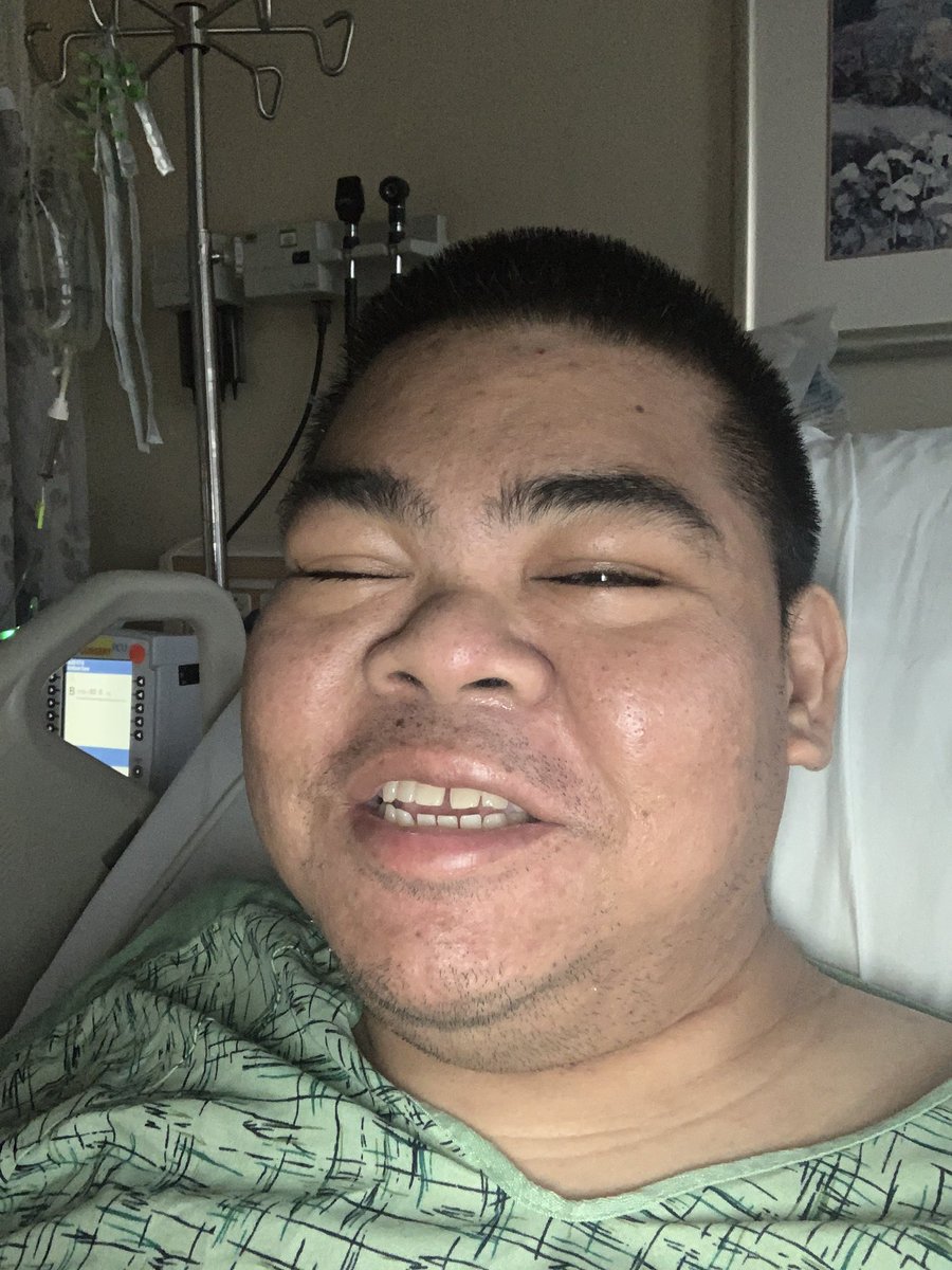 feelzebub's tweet photo. 19 hours post-transplant and I’m finally sitting up in bed. Most importantly, pain is down from an 11 to about a 6, AND my transplanted kidney is responding and producing urine. I am so thankful for all your prayers, thoughts, and well-wishes. Still a long way, though. https://t.co/RAvhHQo4tB
