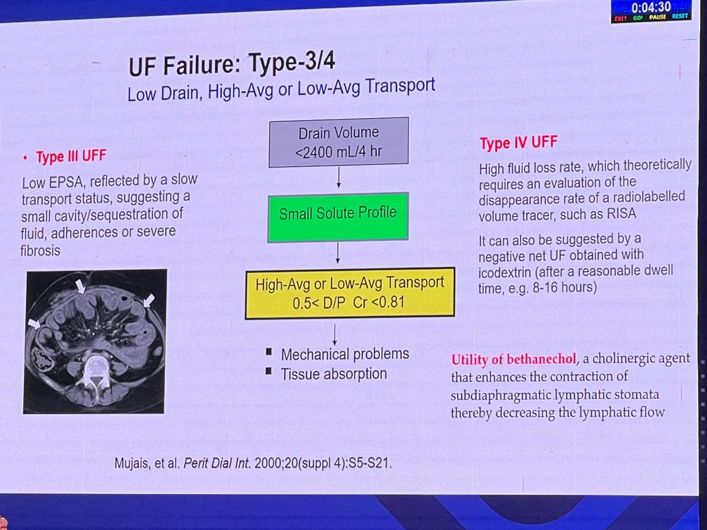 nyiminhan's tweet photo. 6/10
💡4 types of UFF according to small solute profile #ispd23 https://t.co/cjDOm9t2o5