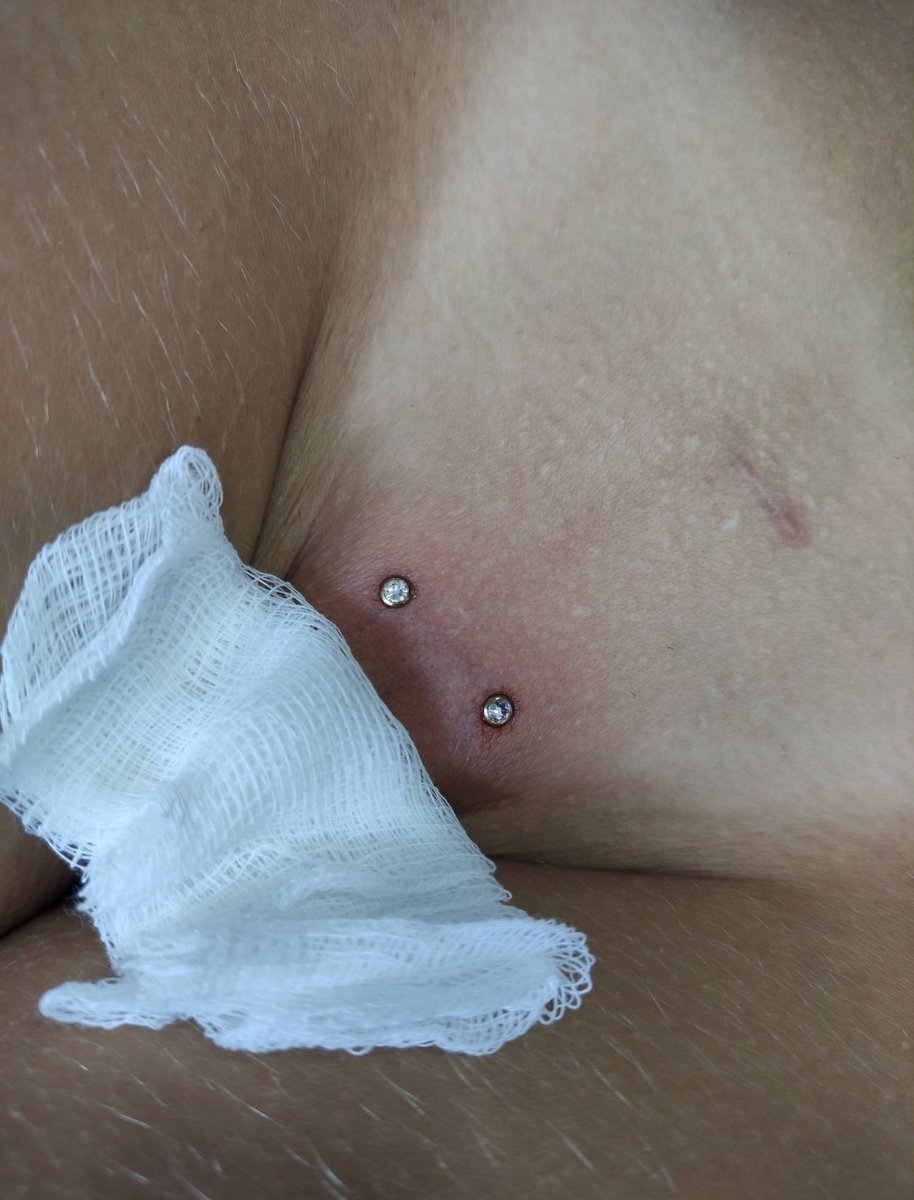 piercerlizzy's tweet photo. Já tinha imaginado que é possível um ponto de luz na Larissinha?
Neste caso a cliente optou por dois microdermais nesta região e ficou uma graça 😊
#piercing #piercercanoas #piercingintimo # https://t.co/ks5KE3YClH