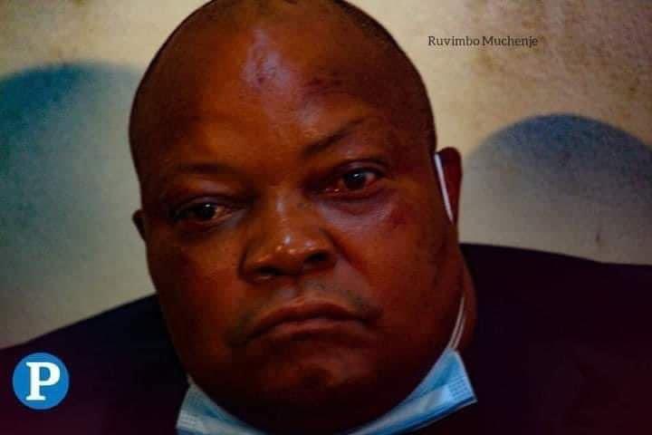 hon_mugari's tweet photo. π―οΈπ―οΈπ―οΈπ―οΈ Tonight, my heart aches as I remember Job Sikhala and all political prisoners in Zimbabwe. They're incarcerated for daring to speak out, for having different political opinions. Let us unite in demanding their unconditional release from prison. #FreeSikhala
@ali_naka @MakomboreroH @maDube_ @ChrisMaroleng @CCCZimbabwe @SOneblow