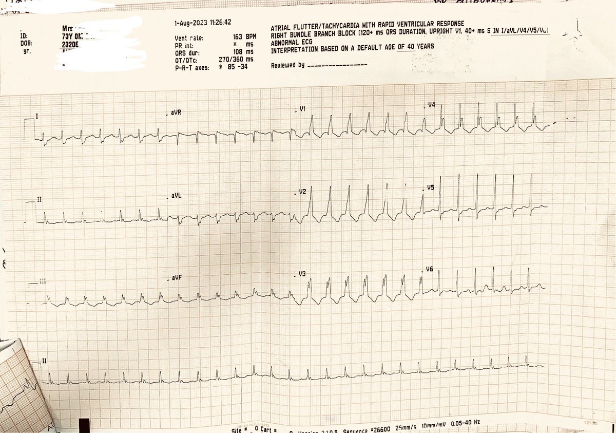 UlhasDr's tweet photo. Wide or Narrow?
SVT or VT? https://t.co/YwrOROnq4l