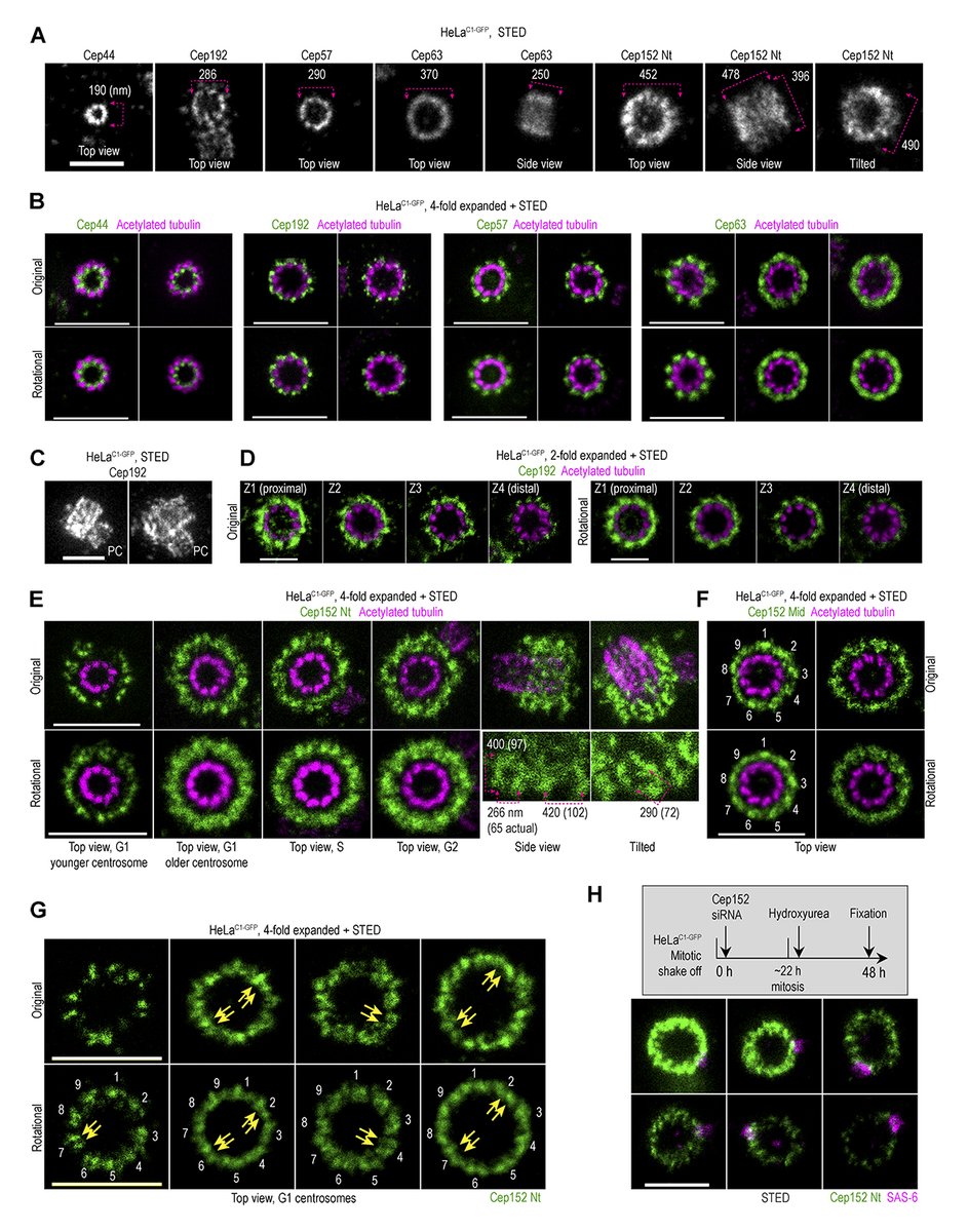Rockefeller U. Press (@rockupress) on Twitter photo In <a href="/JCellBiol/">Journal of Cell Biology</a>, <a href="/c_sullenberger/">Catherine Sullenberger</a>, Loncarek et al. @NCIResearchCtr <a href="/theNCI/">National Cancer Institute</a> dissect the centrosomal patterning of Plk4 during #centriole duplication & amplification and the positioning of Plk4 & procentrioles in relation to mother centriole #microtubules. bit.ly/3Phdd6c In <a href="/JCellBiol/">Journal of Cell Biology</a>, <a href="/c_sullenberger/">Catherine Sullenberger</a>, Loncarek et al. @NCIResearchCtr <a href="/theNCI/">National Cancer Institute</a> dissect the centrosomal patterning of Plk4 during #centriole duplication & amplification and the positioning of Plk4 & procentrioles in relation to mother centriole #microtubules. bit.ly/3Phdd6c
