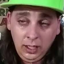 My bedroom is infested with bees and my butthole burns with diarrhea.