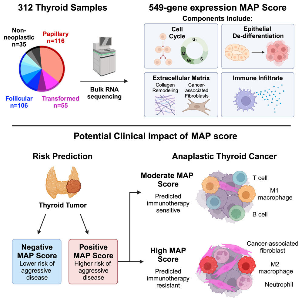 Vivian Weiss (@drvivianweiss) on Twitter photo 1/10 Thrilled to congratulate our incredible team including trainees <a href="/XG372669/">George Xu, PhD</a>, @lobergMatthew, <a href="/mtigue13/">Megan Tigue '16</a> on our recent publication in <a href="/CellGenomics/">Cell Genomics</a> (cell.com/cell-genomics/…). We use multi-omics methods to advance our understanding of thyroid cancer. 1/10 Thrilled to congratulate our incredible team including trainees <a href="/XG372669/">George Xu, PhD</a>, @lobergMatthew, <a href="/mtigue13/">Megan Tigue '16</a> on our recent publication in <a href="/CellGenomics/">Cell Genomics</a> (cell.com/cell-genomics/…). We use multi-omics methods to advance our understanding of thyroid cancer.
