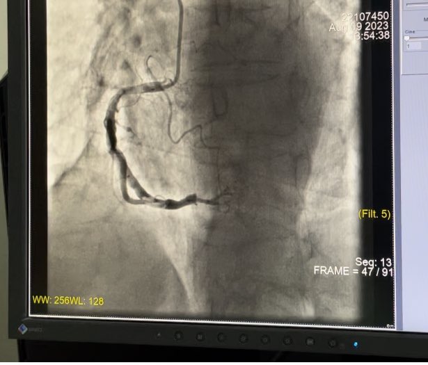 PAOVERA20's tweet photo. Primera clase todo un éxito! 
Síndrome coronario☑️
Manejo paciente de cx cardiovascular ☑️ https://t.co/JV9CLxLYF2