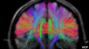 neuroconsciente's tweet photo. Se denomina #conectoma cerebral al mapa de las conexiones neuronales que configuran los circuitos nerviosos, en los que se produce la asociación funcional de diversas estructuras cerebrales. Cuando se alteran dichas conexiones se afecta el funcionamiento de circuitos y órganos. https://t.co/y8Lntm6o68