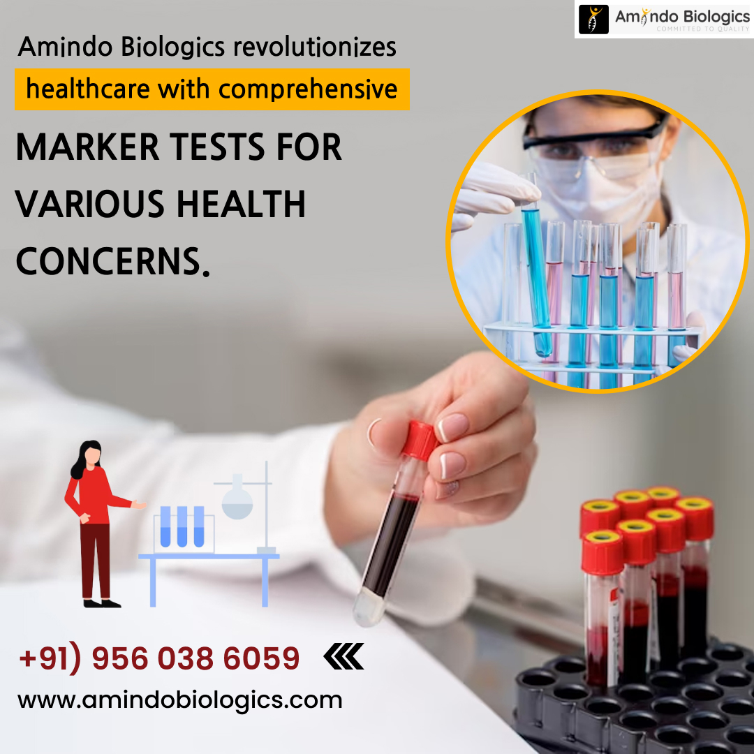 Amindo Biologics: Pioneering a Health Revolution! 
Discover the Future of Healthcare with Our Comprehensive Marker Tests for Various Health Concerns. 

#AmindoBiologics #HealthRevolution #ComprehensiveTesting #HealthcareInnovation #StayHealthy #FutureOfHealthcare