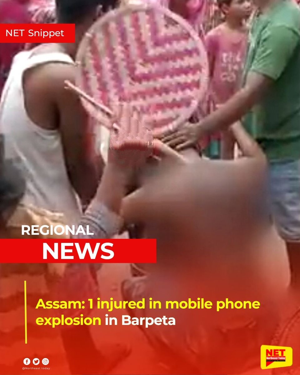 NortheastToday's tweet image. #Assam | As per reports, a resident of Barpeta , one Mayaz-uddin has been seriously injured when his mobile phone blew up and exploded.

Read more..
m.facebook.com/story.php?stor…

#mobileexplosion #injury #treatment #barpeta #NetSnippet #NortheastToday