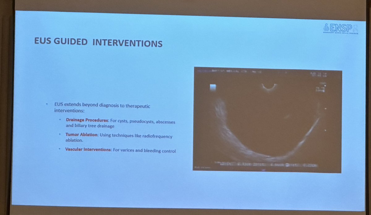 ITS HAPPENING!! #ENSP 👏🏼
<a href="/SGA_KSA/">الجمعية السعودية للجهاز الهضمي Saudi Gastro</a>
